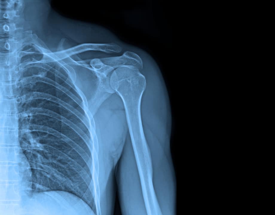 x-ray screening